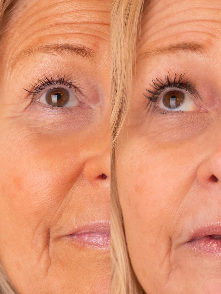 Eyelash Growth Serum