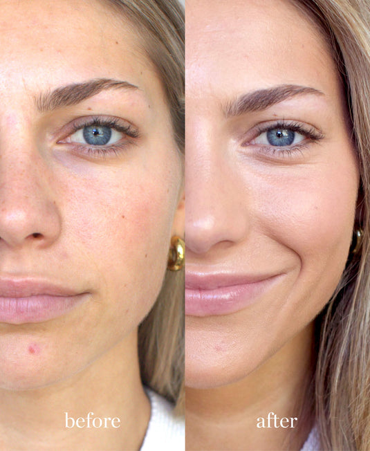 Arnica All-Cover Concealer