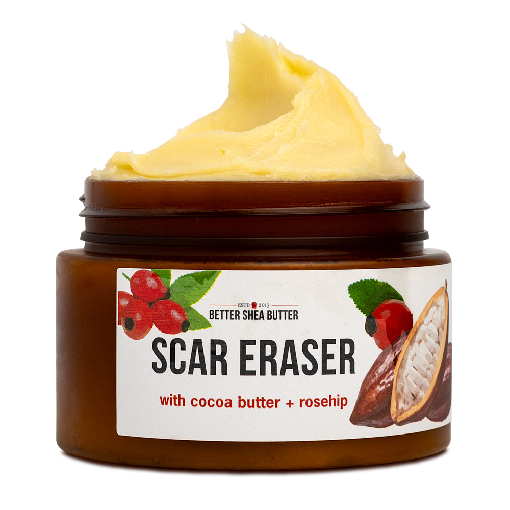 Scar Eraser with Cocoa Butter
